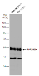 Anti-PPP2R2D antibody [N2C3] used in Western Blot (WB). GTX116609