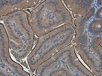 Anti-PPP2R2D antibody [N2C3] used in IHC (Paraffin sections) (IHC-P). GTX116609