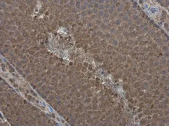 Anti-PPP2R2D antibody [N2C3] used in IHC (Paraffin sections) (IHC-P). GTX116609