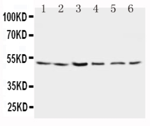Anti-Presenilin 2 antibody used in Western Blot (WB). GTX11661
