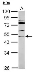 Anti-MDS028 antibody [N1C1] used in Western Blot (WB). GTX116611