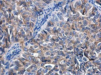 Anti-KIZUNA antibody [N2C1], Internal used in IHC (Paraffin sections) (IHC-P). GTX116612