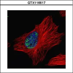 Anti-Myoneurin antibody used in Immunocytochemistry/ Immunofluorescence (ICC/IF). GTX116617