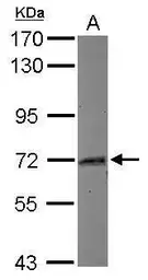 Anti-Myoneurin antibody used in Western Blot (WB). GTX116617