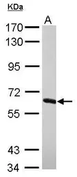 Anti-NXF2 antibody used in Western Blot (WB). GTX116623