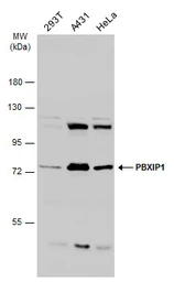 Anti-PBXIP1 antibody used in Western Blot (WB). GTX116669