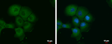 Anti-PBXIP1 antibody used in Immunocytochemistry/ Immunofluorescence (ICC/IF). GTX116669