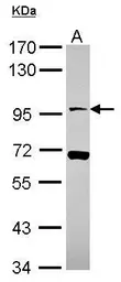 Anti-NLGN4X antibody [N1N3] used in Western Blot (WB). GTX116674