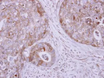 Anti-KIF17 antibody [C2C3], C-term used in IHC (Paraffin sections) (IHC-P). GTX116681