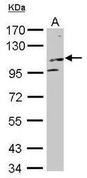 Anti-KIF17 antibody [C2C3], C-term used in Western Blot (WB). GTX116681