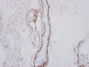 Anti-SH3MD2 antibody [N3C1], Internal used in IHC (Paraffin sections) (IHC-P). GTX116687