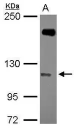 Anti-SH3MD2 antibody [N3C1], Internal used in Western Blot (WB). GTX116687