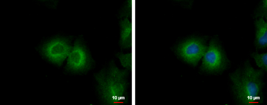 Anti-CYP4F11 antibody [N1N3] used in Immunocytochemistry/ Immunofluorescence (ICC/IF). GTX116701