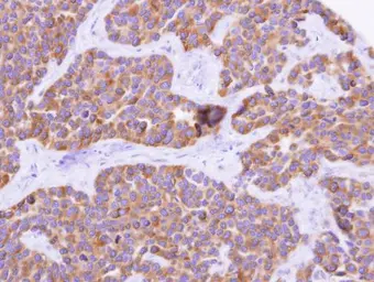 Anti-CYP4F11 antibody [N1N3] used in IHC (Paraffin sections) (IHC-P). GTX116701