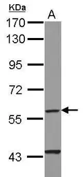 Anti-CYP4F11 antibody [N1N3] used in Western Blot (WB). GTX116701