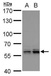 Anti-PTBP2 antibody [C1C3] used in Western Blot (WB). GTX116703
