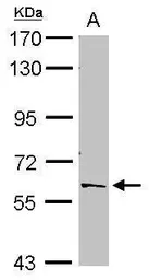 Anti-PTBP2 antibody [C1C3] used in Western Blot (WB). GTX116703