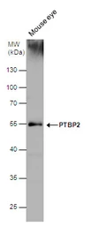 Anti-PTBP2 antibody used in Western Blot (WB). GTX116704