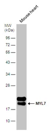 Anti-MYL7 antibody used in Western Blot (WB). GTX116713