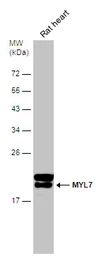 Anti-MYL7 antibody used in Western Blot (WB). GTX116713