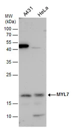 Anti-MYL7 antibody used in Western Blot (WB). GTX116713
