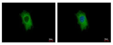 Anti-CIDEC antibody used in Immunocytochemistry/ Immunofluorescence (ICC/IF). GTX116733