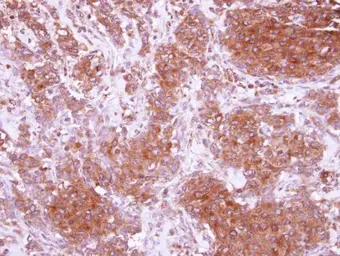 Anti-CIDEC antibody used in IHC (Paraffin sections) (IHC-P). GTX116733