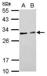Anti-CIDEC antibody used in Western Blot (WB). GTX116733