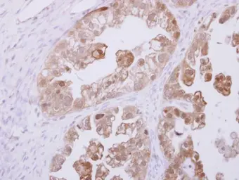 Anti-RBKS antibody [N1C1] used in IHC (Paraffin sections) (IHC-P). GTX116738