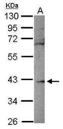 Anti-RBKS antibody [N1C1] used in Western Blot (WB). GTX116738
