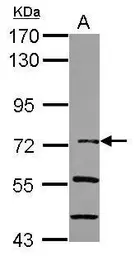 Anti-IKB zeta antibody [N3C3] used in Western Blot (WB). GTX116752