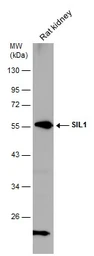 Anti-SIL1 antibody [N1N3] used in Western Blot (WB). GTX116755