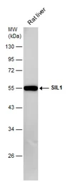 Anti-SIL1 antibody [N1C2] used in Western Blot (WB). GTX116756