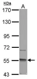Anti-GMCL1 antibody [C1C3] used in Western Blot (WB). GTX116759