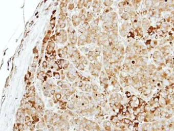Anti-MTMR14 antibody [N2C2], Internal used in IHC (Paraffin sections) (IHC-P). GTX116762