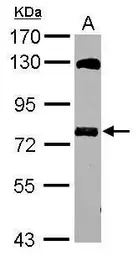 Anti-MTMR14 antibody [N2C2], Internal used in Western Blot (WB). GTX116762