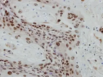 Anti-PRAF1 antibody [C1C3] used in IHC (Paraffin sections) (IHC-P). GTX116763