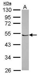 Anti-PRAF1 antibody [C1C3] used in Western Blot (WB). GTX116763