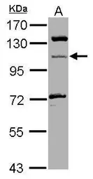 Anti-MICAL1 antibody [N1N3] used in Western Blot (WB). GTX116770