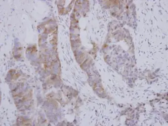 Anti-BOLL antibody used in IHC (Paraffin sections) (IHC-P). GTX116790