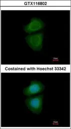 Anti-WDR77 antibody [N2C3] used in Immunocytochemistry/ Immunofluorescence (ICC/IF). GTX116802