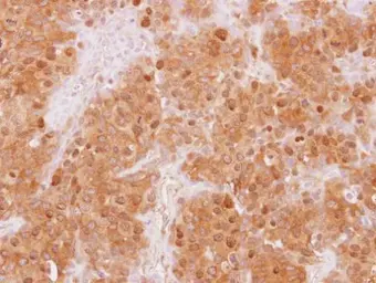 Anti-WDR77 antibody [N2C3] used in IHC (Paraffin sections) (IHC-P). GTX116802
