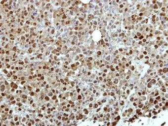 Anti-ZNF426 antibody [N1N3] used in IHC (Paraffin sections) (IHC-P). GTX116805