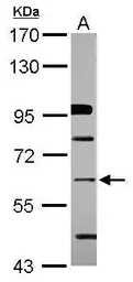 Anti-ZNF426 antibody [N1N3] used in Western Blot (WB). GTX116805