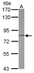 Anti-FLJ21908 antibody used in Western Blot (WB). GTX116827