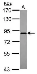 Anti-FLJ21908 antibody used in Western Blot (WB). GTX116827