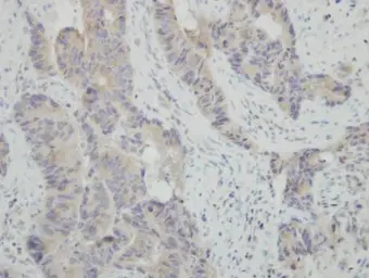 Anti-HSPBAP1 antibody [N2C1], Internal used in IHC (Paraffin sections) (IHC-P). GTX116828