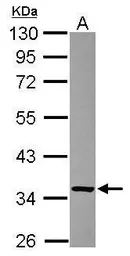 Anti-FN3KRP antibody [N2C3] used in Western Blot (WB). GTX116830