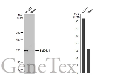 Anti-SMC6L1 antibody [N3C2], Internal used in Western Blot (WB). GTX116832