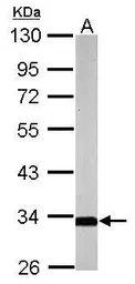 Anti-SLC25A22 antibody [N1C3-2] used in Western Blot (WB). GTX116838